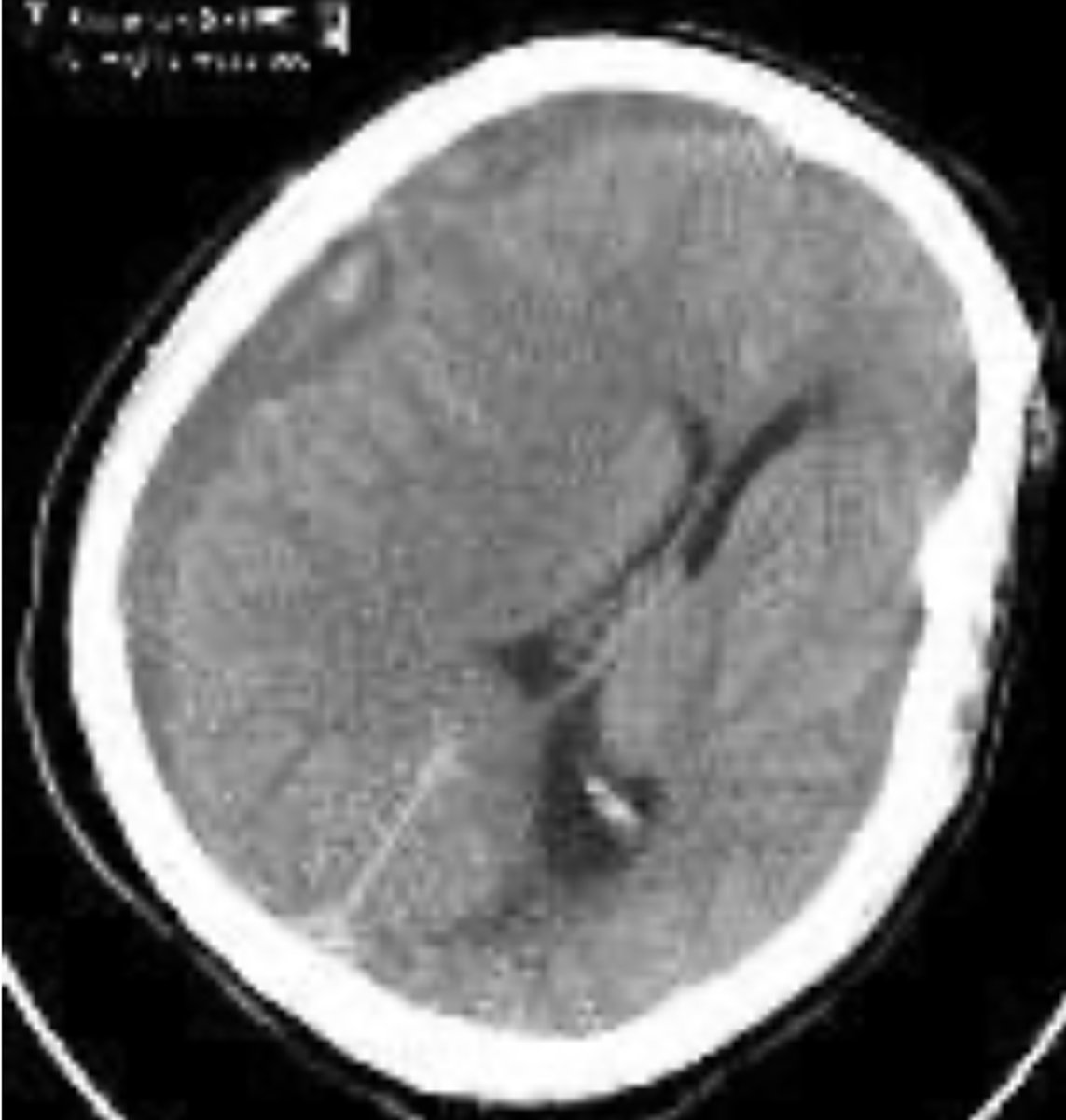 <p>What is the diagnosis?</p>