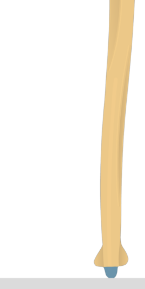 <p>What is this pointing to? What bone is it on?</p>