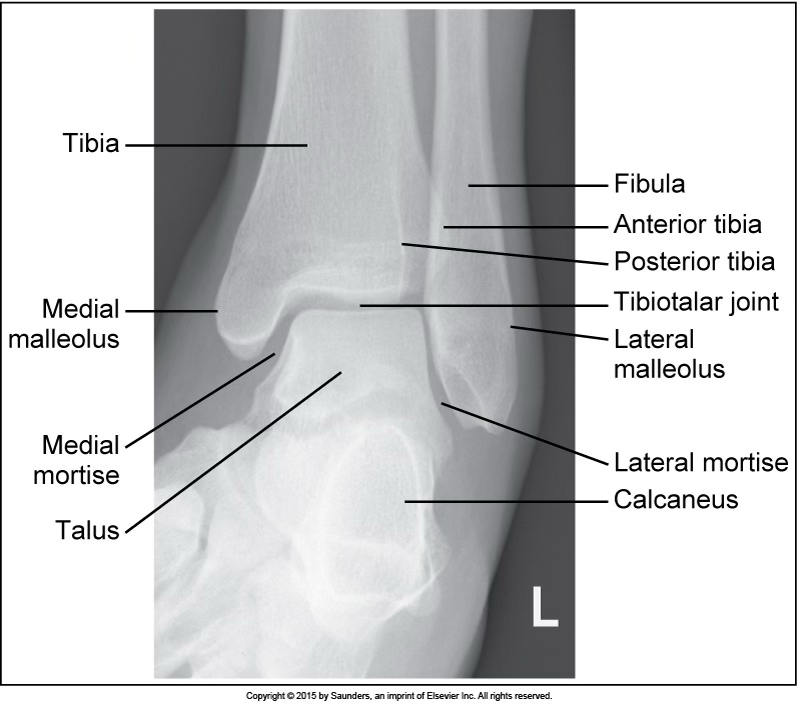 <p>AP oblique ankle (mortise)</p>