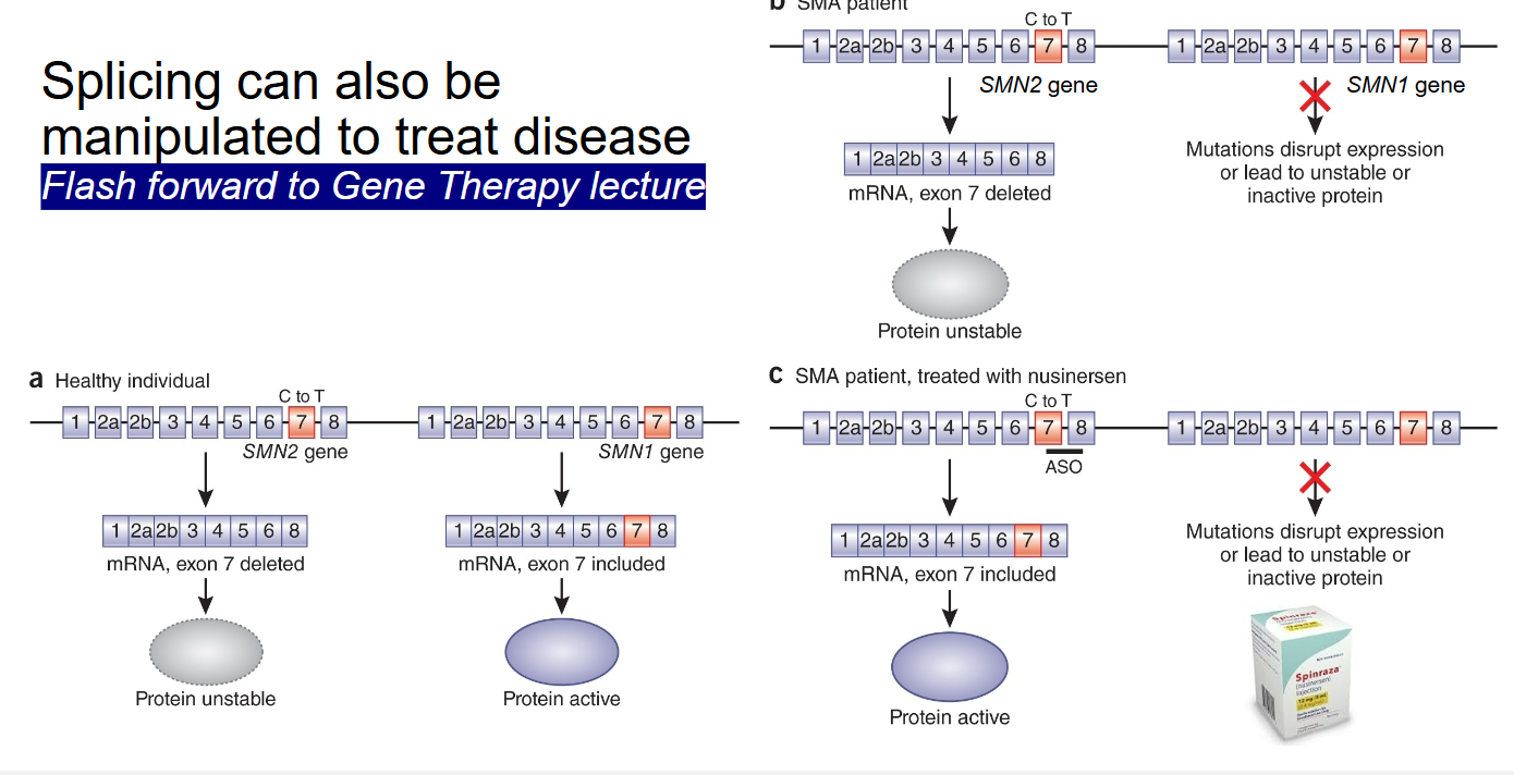 <p>SMA patient treated with nusinersen (modifies the SMN2 gene)</p>