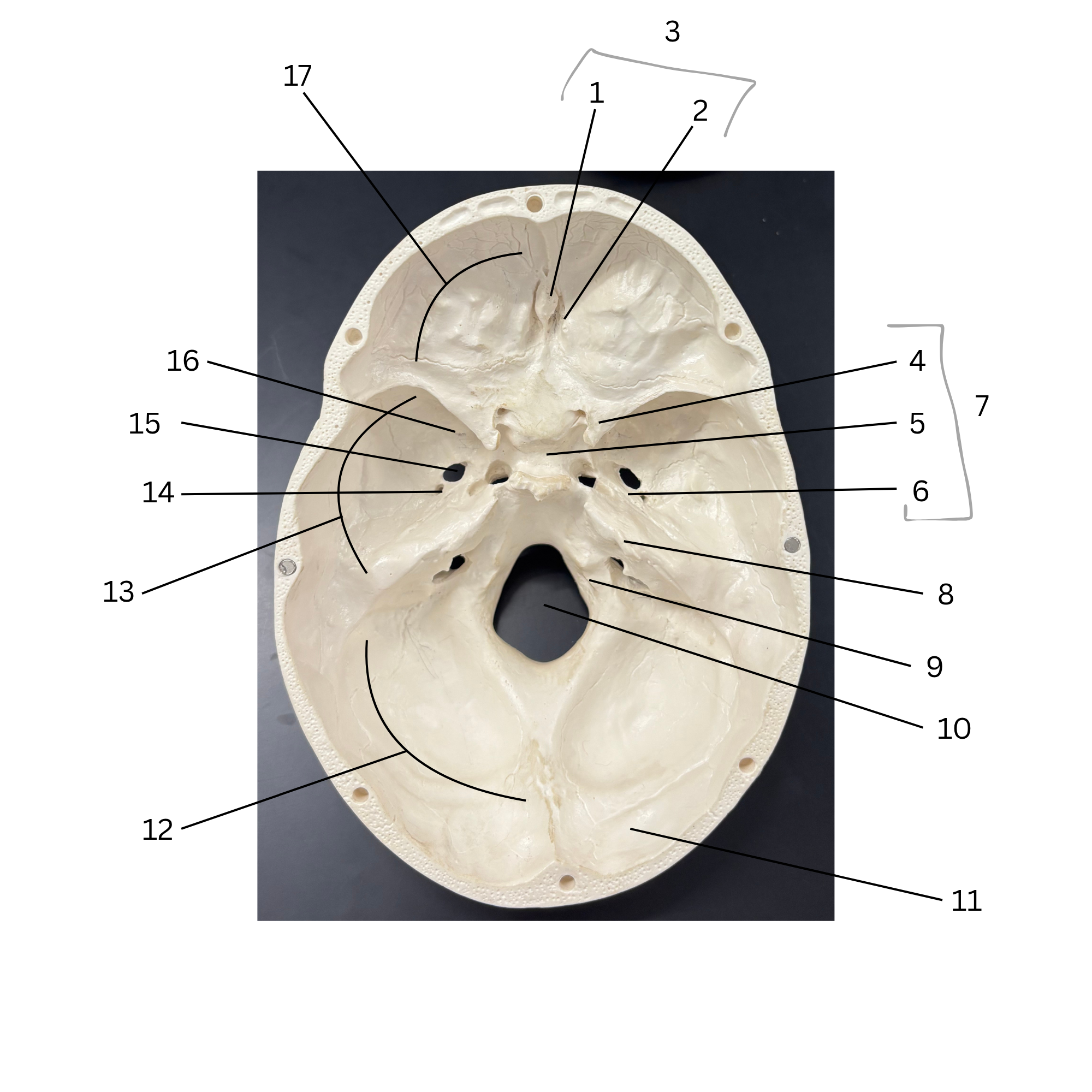<p>5</p>