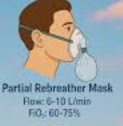 <ul><li><p><span><span>Mix of supplemental O2 and RA</span></span></p></li><li><p><span><span>Provides a high FiO2 to the patient while conserving the O2 supply</span></span></p></li><li><p><span><span>Two-way valves in the mask allow for RA inhalation in addition to supplemental O2.</span></span></p></li><li><p><span><span>Fio2 - 40 to 60%</span></span></p></li></ul><p></p>