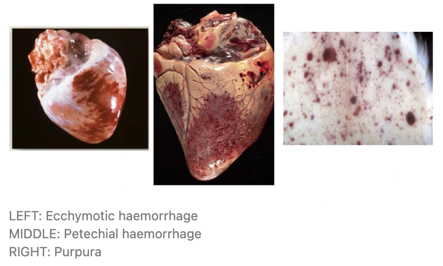 <p><strong>Haematoma</strong> = Local accumulation of blood (usually clotted) that causes swelling in tissues</p><p><strong>Petechial Haemorrhage</strong> = Pin-point haemorrhagic spots usually caused by haemorrhage per diapedesis</p><p><strong>Ecchymotic Haemorrhage</strong> = Slightly larger foci of haemorrhage usually caused by haemorrhage per diapedesis</p><p><strong>Purpura</strong> = Skin, MM, viscera haemorrhage</p>