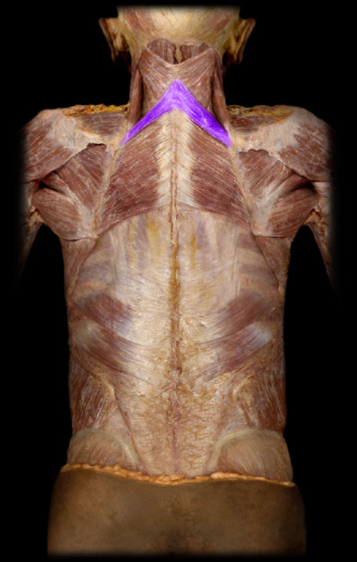 <p>rotate and retract </p>