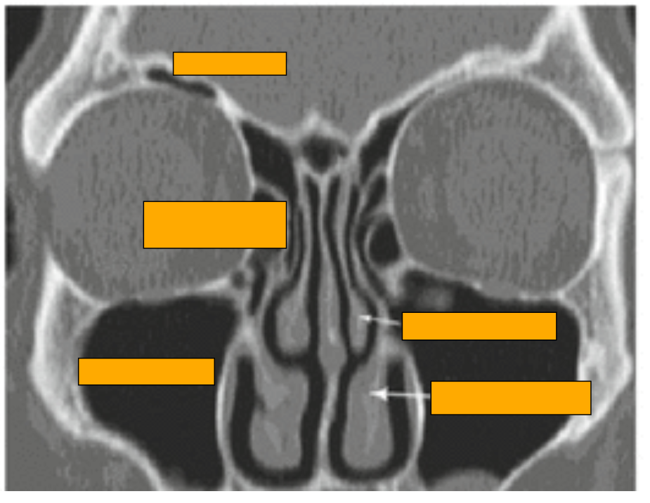 <p>Label this diagram </p>