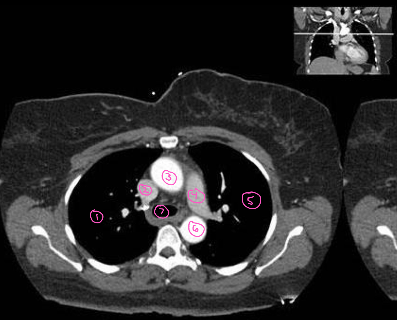 <p>The structure labeled 4 in this image is:</p>