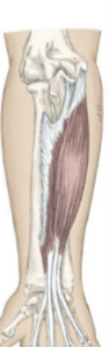 <p>What muscle is being shown?</p>