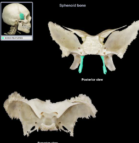 <p>Welk deel van het bot is dit?</p>
