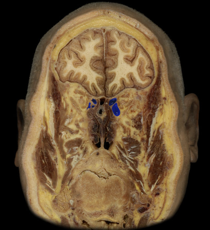 term image