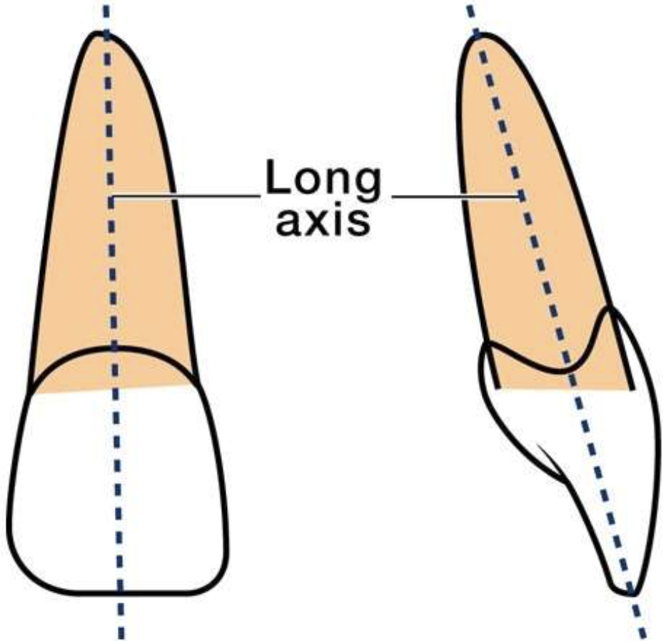 <p>imaginary line thought the centre of the tooth form crown to root</p>