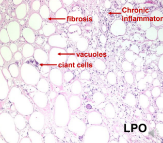 <p>What pathology? </p>