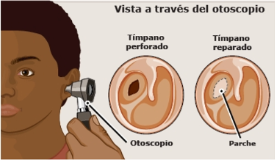 <p>Tossir/estornudar sempre amb la <strong>boca oberta</strong> per evitar canvis de pressió.</p>
