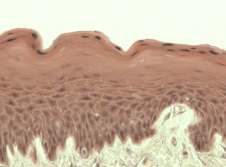 <p>identify this tissue</p>