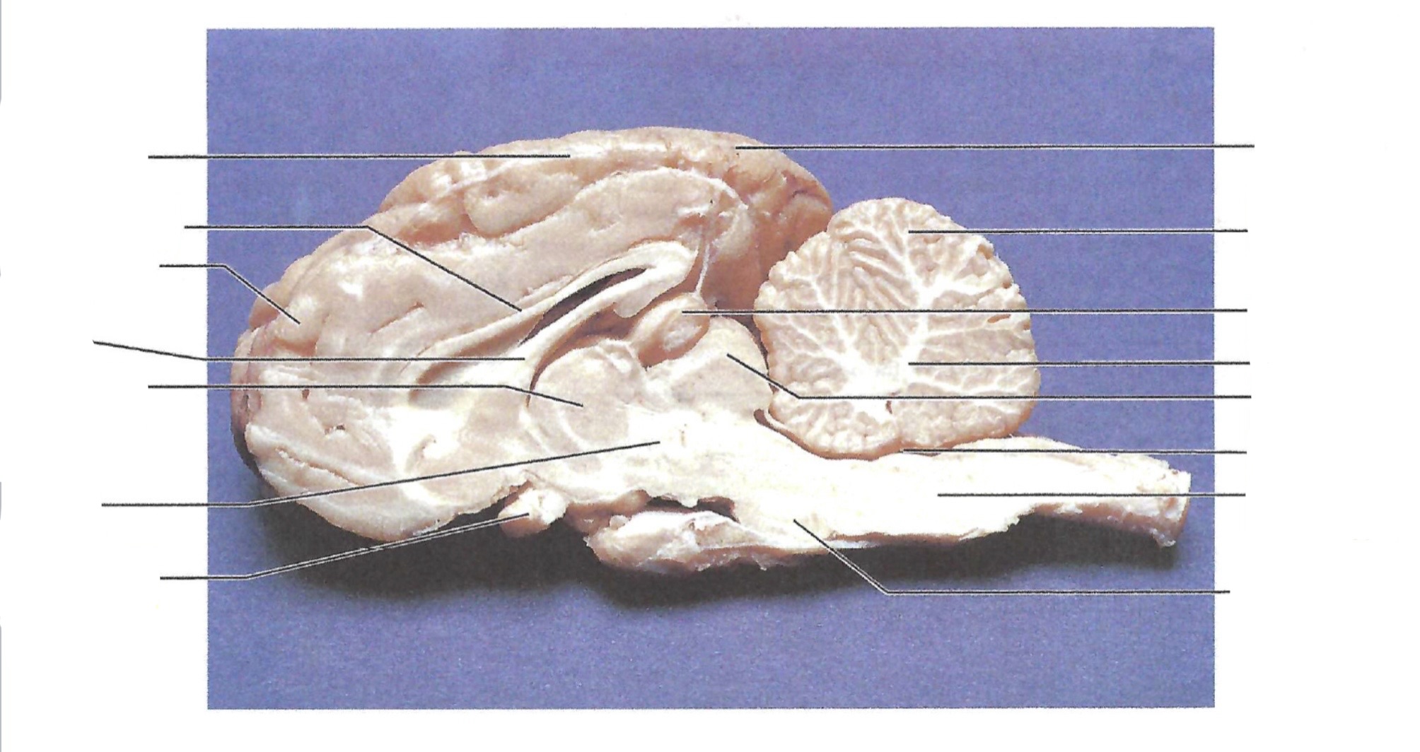 <p><a target="_blank" rel="noopener noreferrer nofollow" class="link" href="https://assets.knowt.com/user-attachments/68436a60-83ff-403e-a601-3cdf90e0e8b9.jpg" data-prevent-progress="true">https://assets.knowt.com/user-attachments/68436a60-83ff-403e-a601-3cdf90e0e8b9.jpg</a></p>