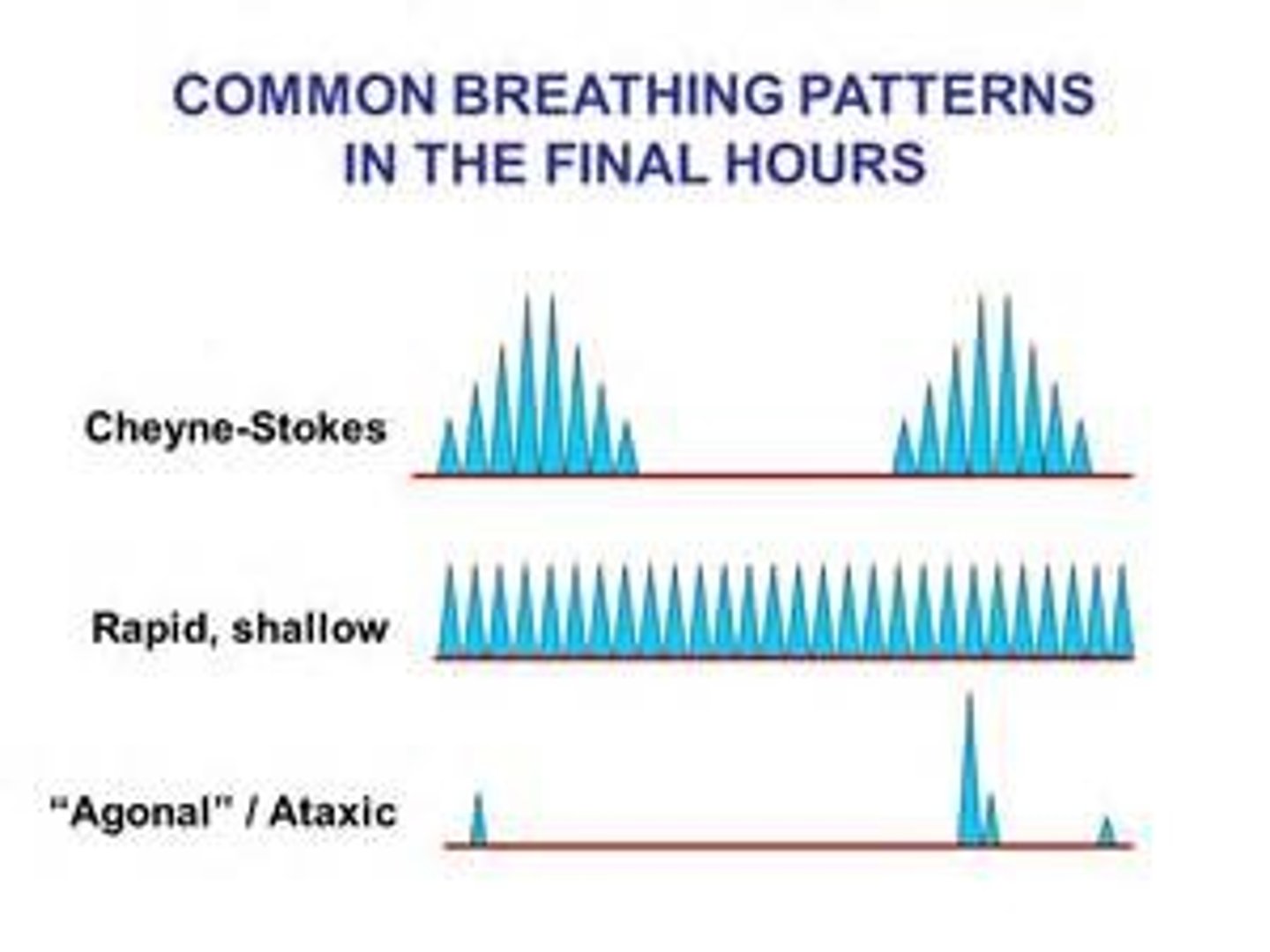 <p>abnormal breathing pattern characterized by slow, gasping breaths, sometimes seen in patients in cardiac arrest</p>