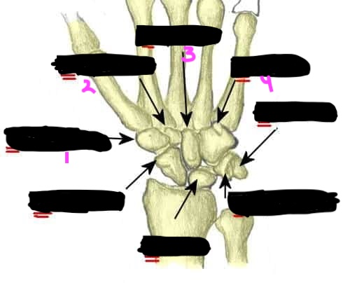 <ol><li><p>trapezium: articulates with the base of the first metacarpal (thumb)</p></li><li><p>trapezoid: articulates with the base of the second metacarpal</p></li><li><p>capitate: the largest carpal bone</p></li><li><p>hamate: has a hook-like process (hook of hamate) on its palmar surface</p></li></ol><p>memory aid - “To Take Claire Home”</p>