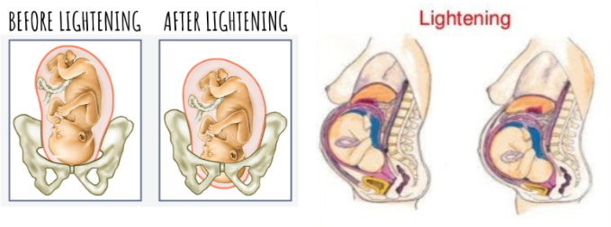 <p>Lightening </p>