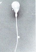 <p>What is this? Normal or abnormal sperm?</p>