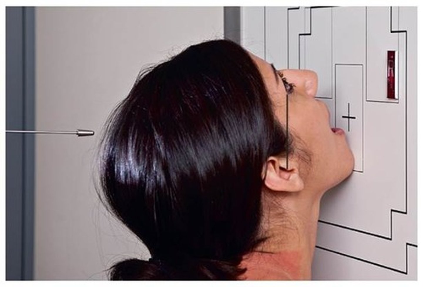<p>S - around waist</p><p>T - center cell, 75 kVp</p><p>A - none</p><p>M - bottom, correct side</p><p>P - MML perp, CR exits acanthion, chin on board and then open mouth</p><p>S - 40"</p><p>B - hold</p><p>C - 8 by 10, L</p>