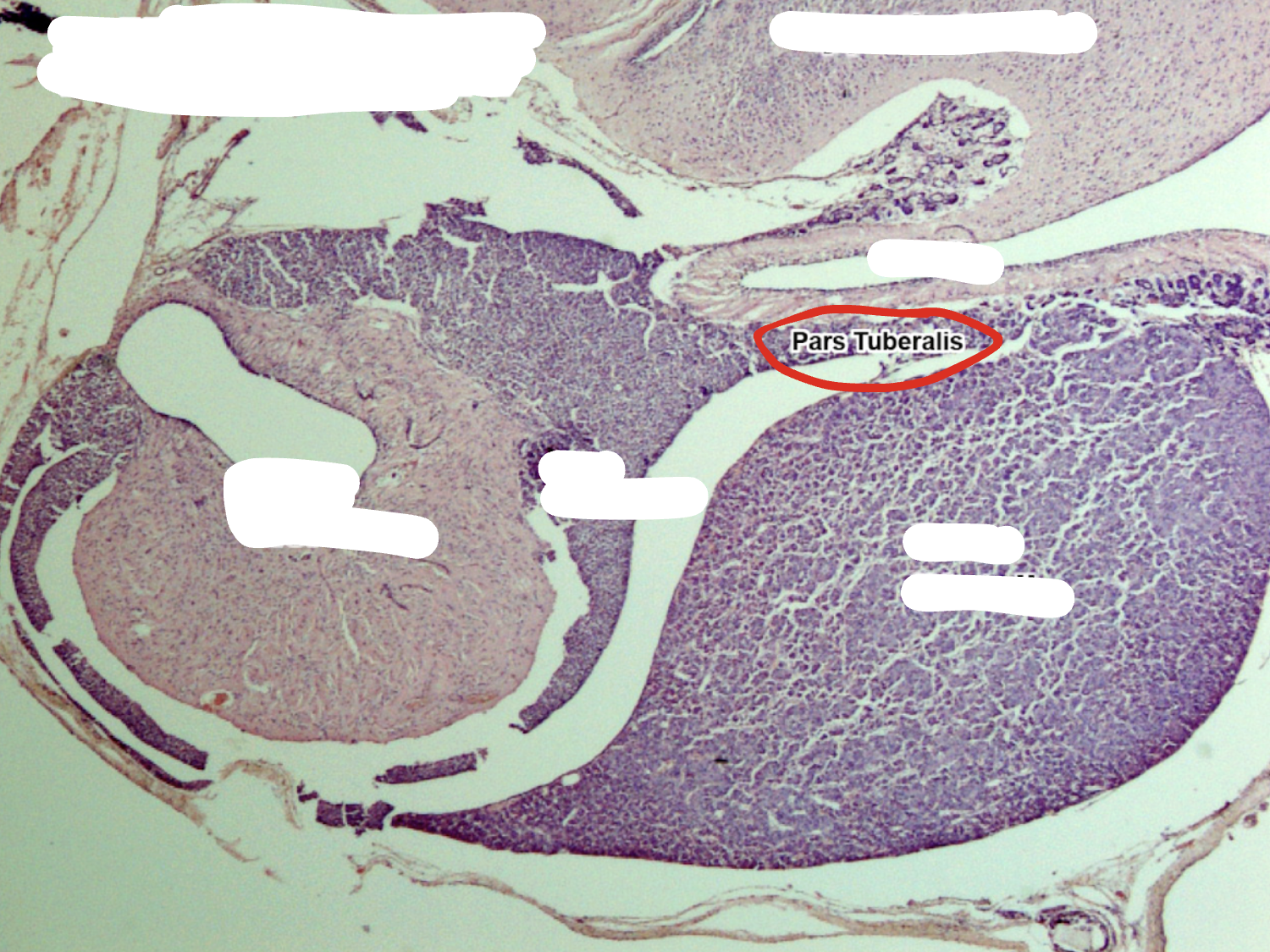 <p>Pars Tuberalis </p>