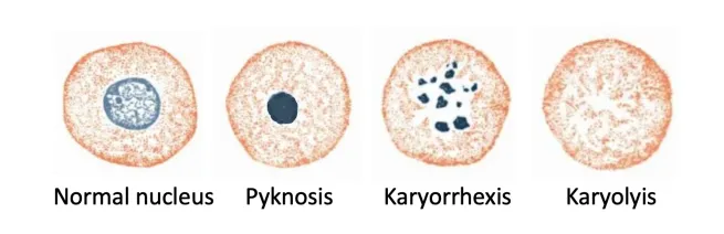 <p>‘fading’ of the nucleus as it loses affinity for haematoxylin (blue staining dye)</p><p><em>Karyolysis= fading of the nucleus: karyon=nucleus (i.e karyograph) +-ysis= loosen/dissolve</em></p>