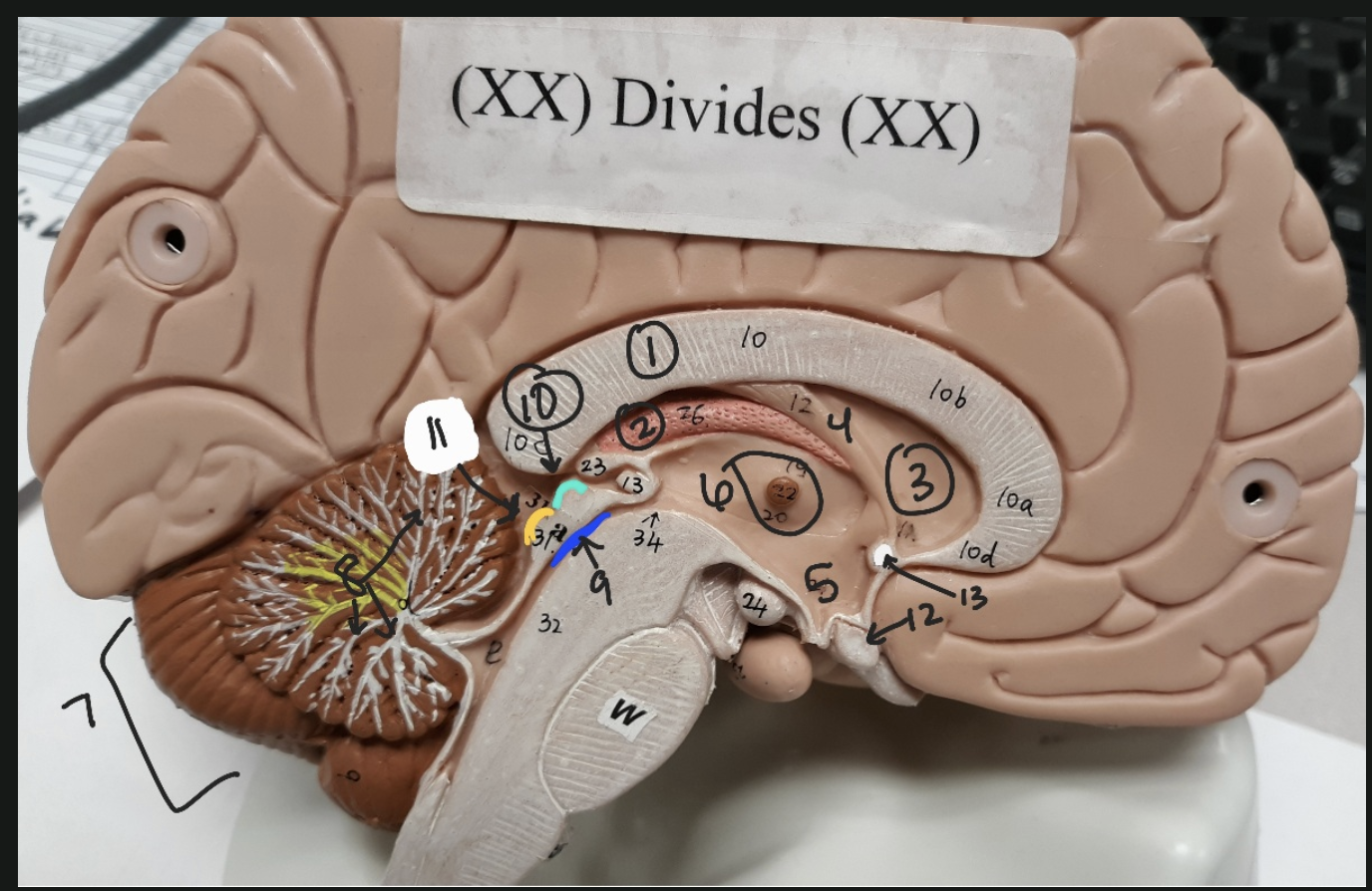 <p>(SAGITTAL VIEW OF BRAIN) Name all numbered brain structures: (1-13)</p>