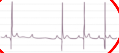 <p><span style="background-color: transparent;">What is the following ECG</span></p>
