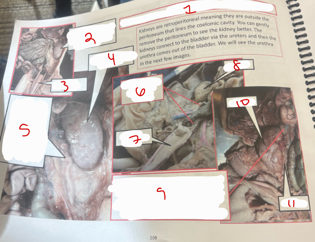 <p>Abdominal Cavity</p>