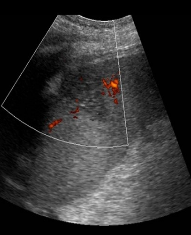 <p>Identify this image. </p>