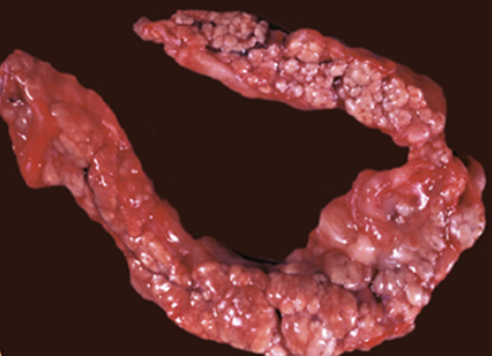 <p><strong>Sätt rätt diagnos på den förändring som ses i bilderna genom att dra rätt ruta till platsen bredvid bilden. Endast en</strong></p><p class="p1"><strong>diagnos per bild. (1.5p)</strong></p>