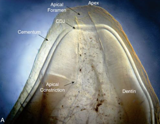 <p>_______ thickens with age. This is why apical constriction occurs within this area</p>