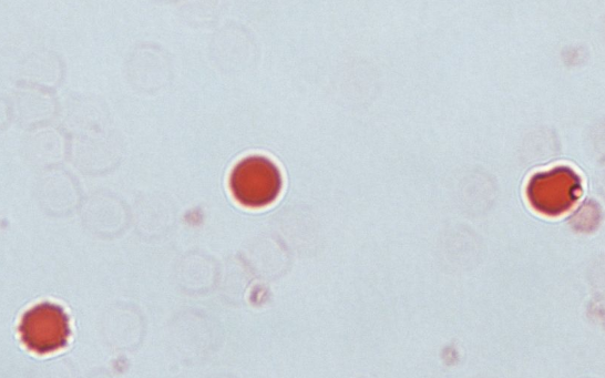 <p>What do the red cells demonstrate in this KB acid elution test?</p>