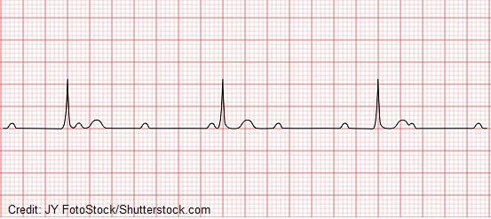 <p>Guess the Rhythm></p>