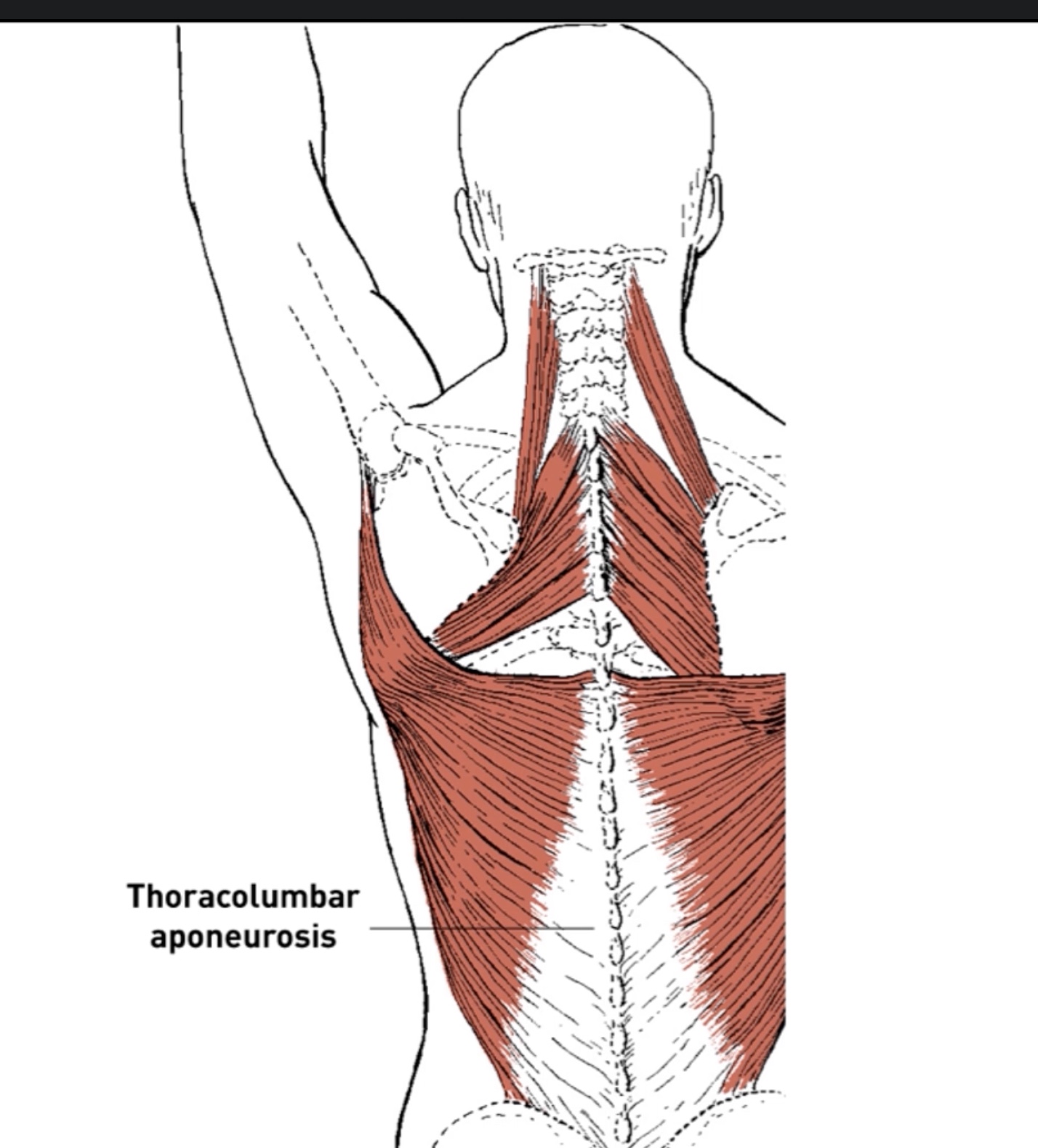 <p>A type of tendon, so it attaches muscle to bone or muscle to muscle. </p>
