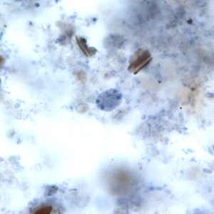 <p>Ellipsoidal, 4-8um. 1, 2 or 4 nuclei (binucleate most common), large central karyosome, no PC</p>