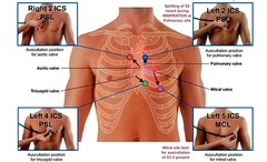 <p>Listening to heart sounds to assess function.</p>