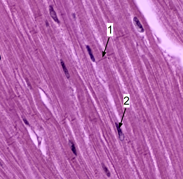 <p>what type of muscle tissue is this?</p>
