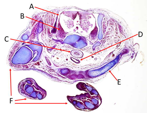 <p>Label A, B, C, D and E</p>