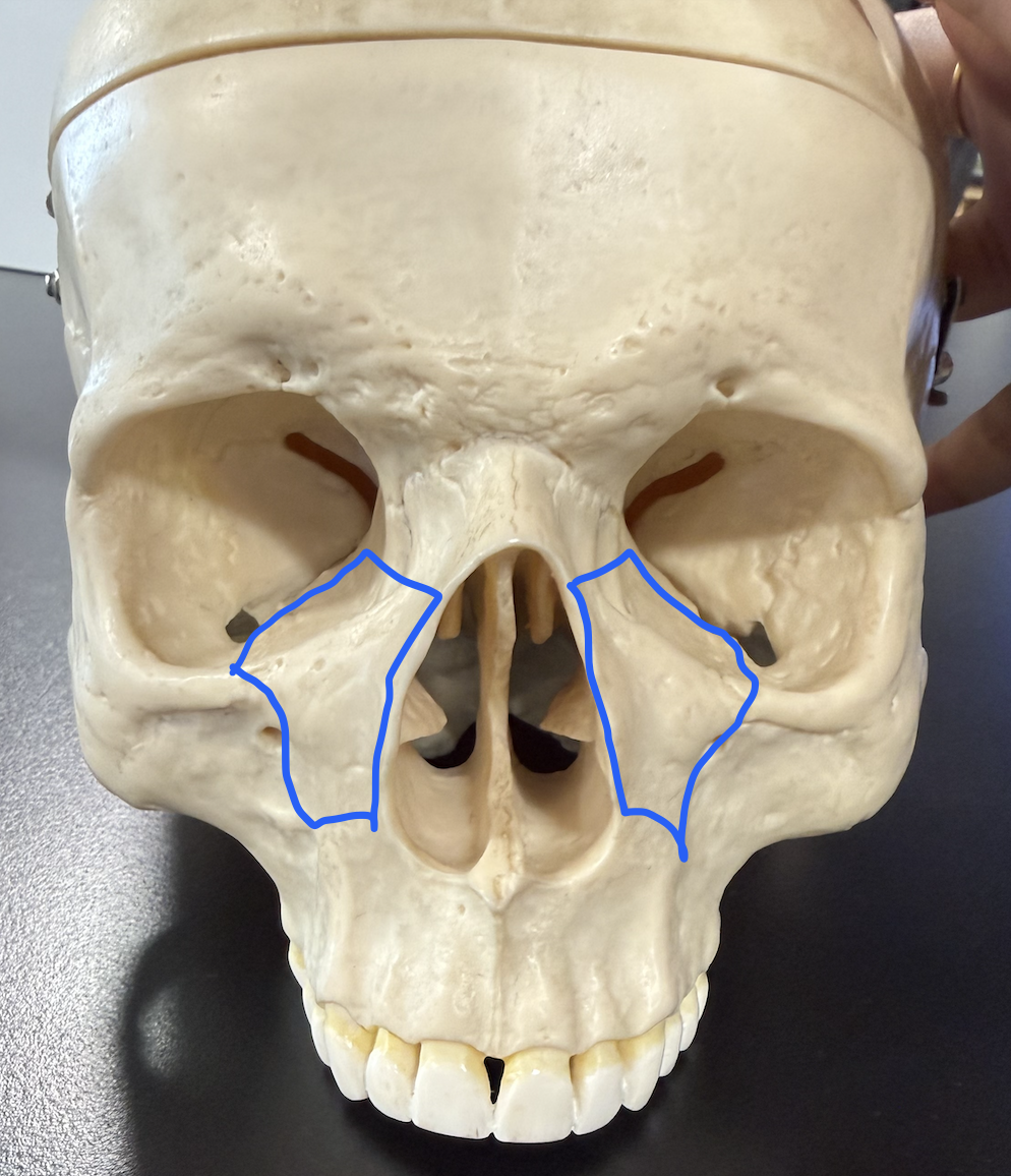 <p>lower medial rim of the orbit</p>