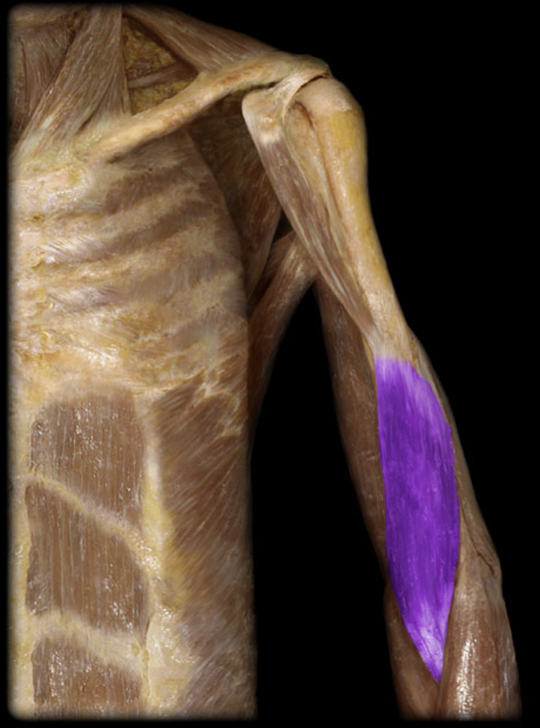 <p>What is the insertion of this muscle?</p>