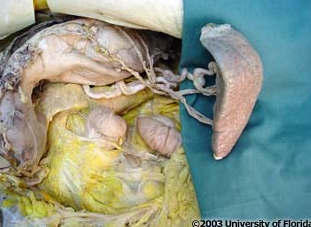 <p>what side of the organ to the right of the image is currently anterior?</p>