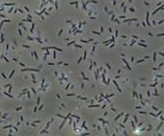 <p>Bacteria</p>