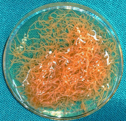 <p>Name this family of nematodes (scientific and common names)</p>