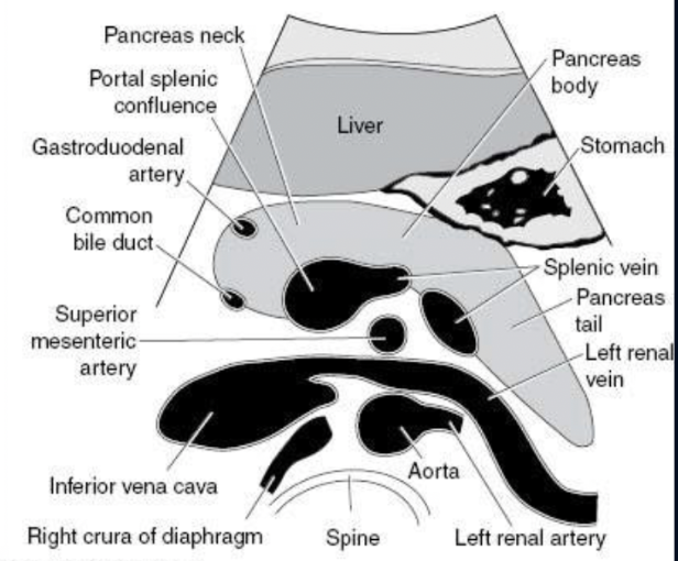 <ul><li><p>Trv Proximal Aorta (SMA lvl)</p></li></ul><p></p>