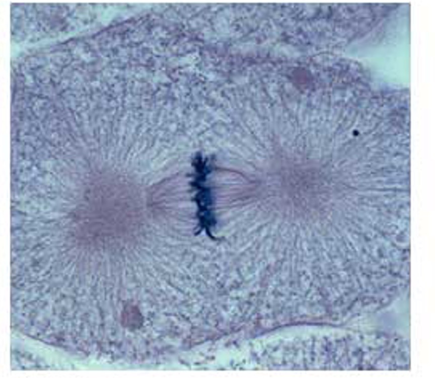 <p>What stage of mitosis is this? </p>