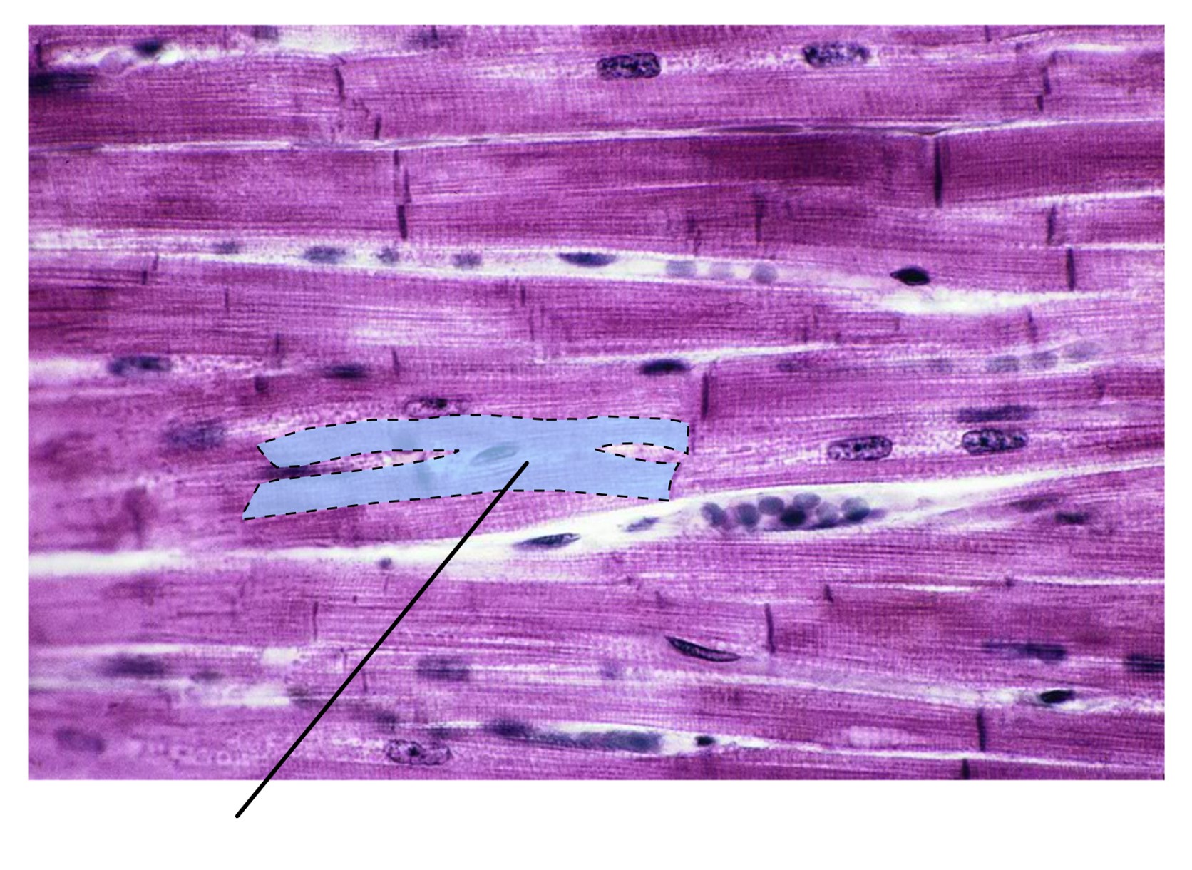 <p><span>What type of cell is highlighted in this image?</span></p>