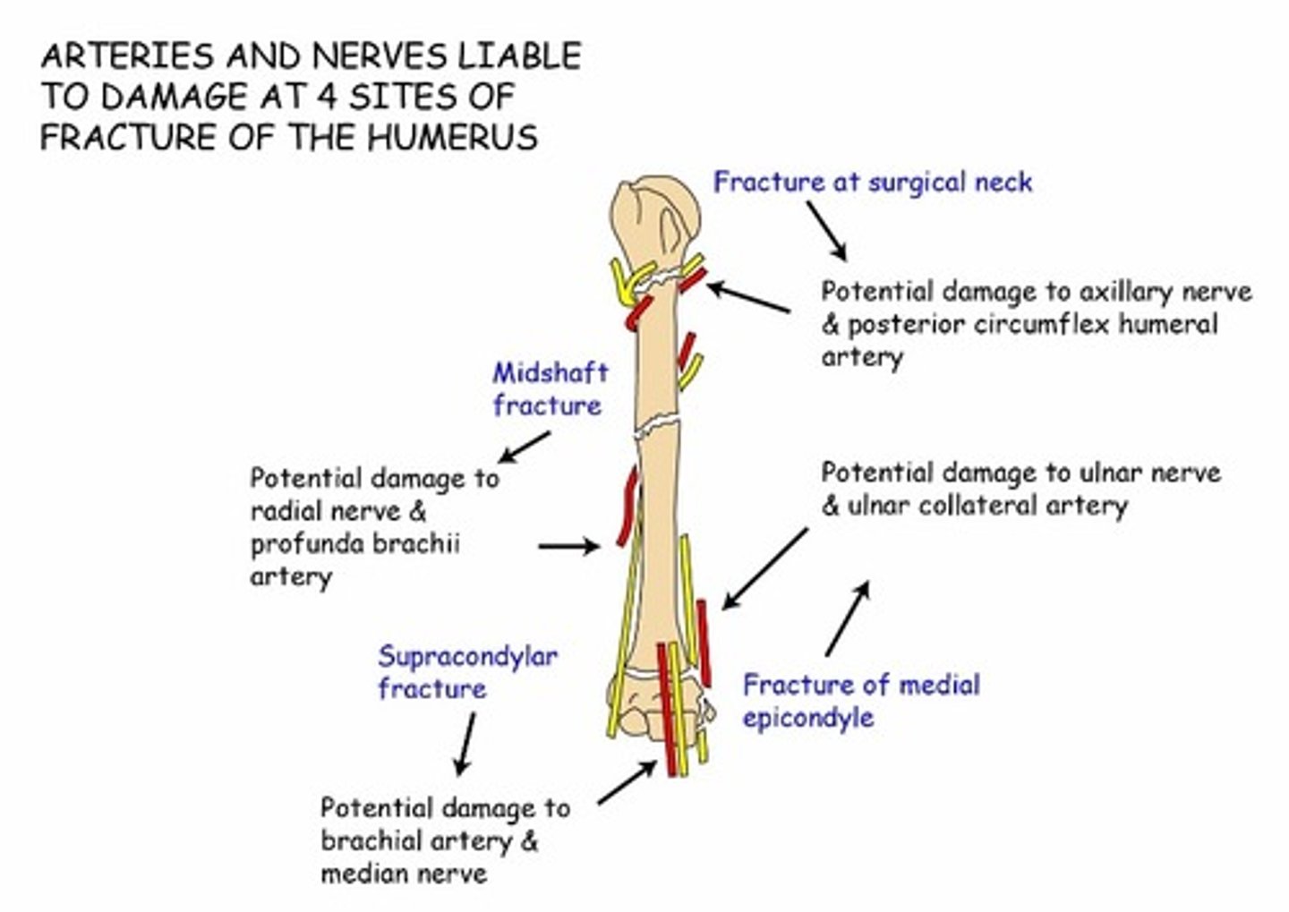 <p>damage to nerves</p><p>hemorrhage</p><p>excess pain</p>