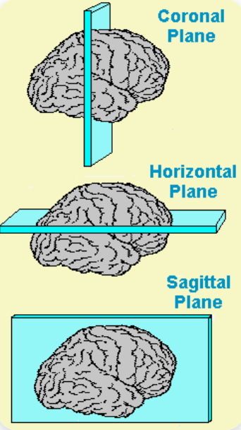 <p>horizontal</p>