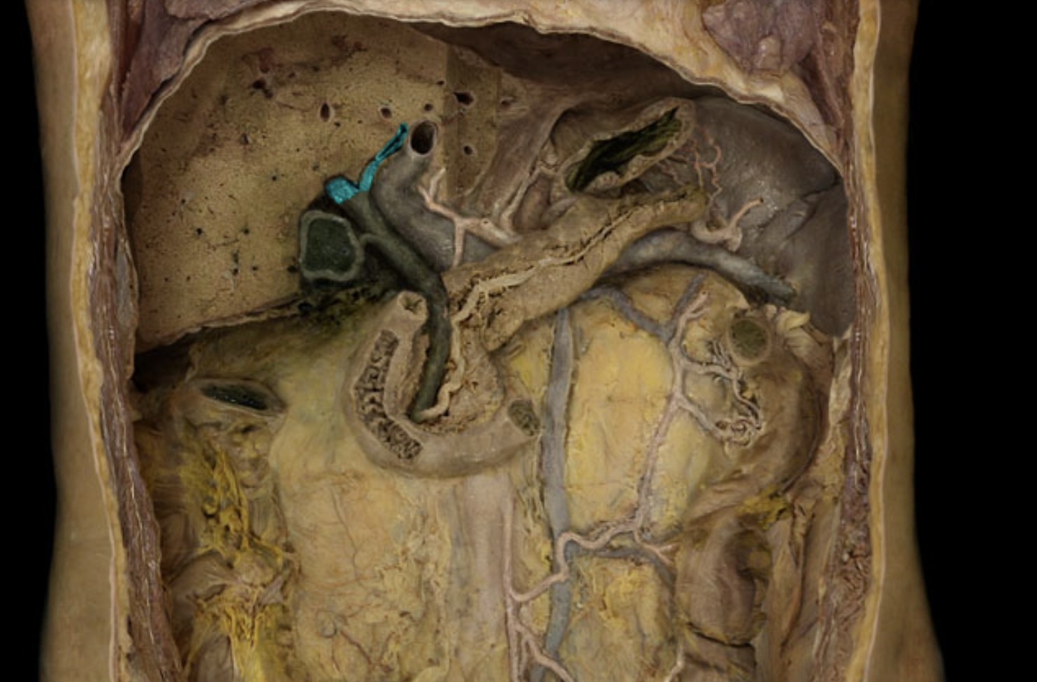 term image