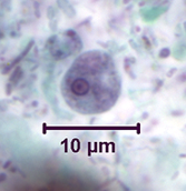 <ul><li><p>Fine granular cytoplasm </p></li><li><p><mark data-color="#afb405" style="background-color: rgb(175, 180, 5); color: inherit;">4-12um </mark></p></li><li><p>ECCENTRIC karyosome </p></li></ul><p>SIZEEEEE!!!!! VERY SMALL </p><p></p>